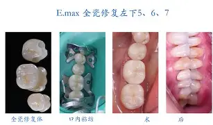 开云体育入口-剠?5{+Z&amp;磟;=^寽跾#y?o\(弜嵌洶鯫e鰱龅